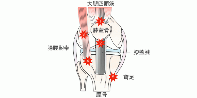腱、靭帯付着部炎の治療