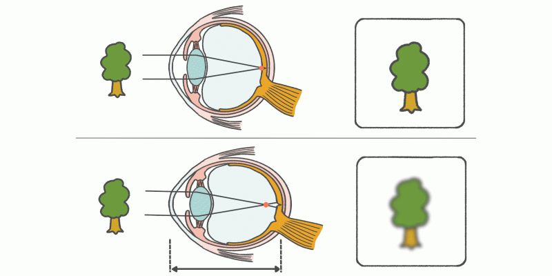 眼で見た近くの物を脳で認識するまでのメカニズム