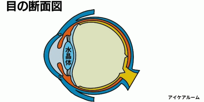 白内障（はくないしょう）