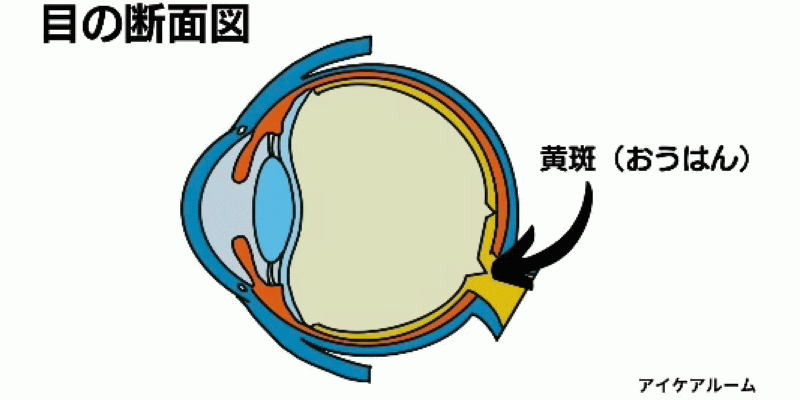 黄斑（おうはん）の病気