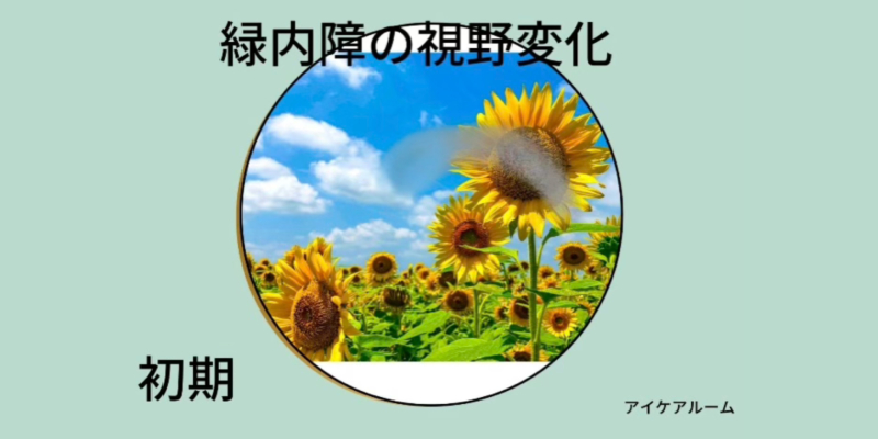 緑内障