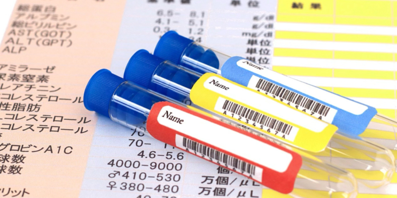 健康診断の代表的な項目を詳しく読み解く