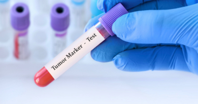 腫瘍マーカーとは？知っておきたい意義と使い方の基本をわかりやすく紹介
