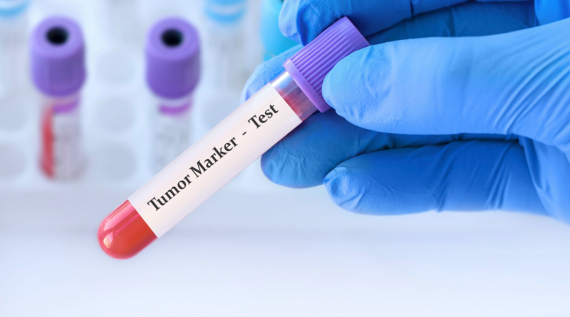 腫瘍マーカーとは？知っておきたい意義と使い方の基本をわかりやすく紹介